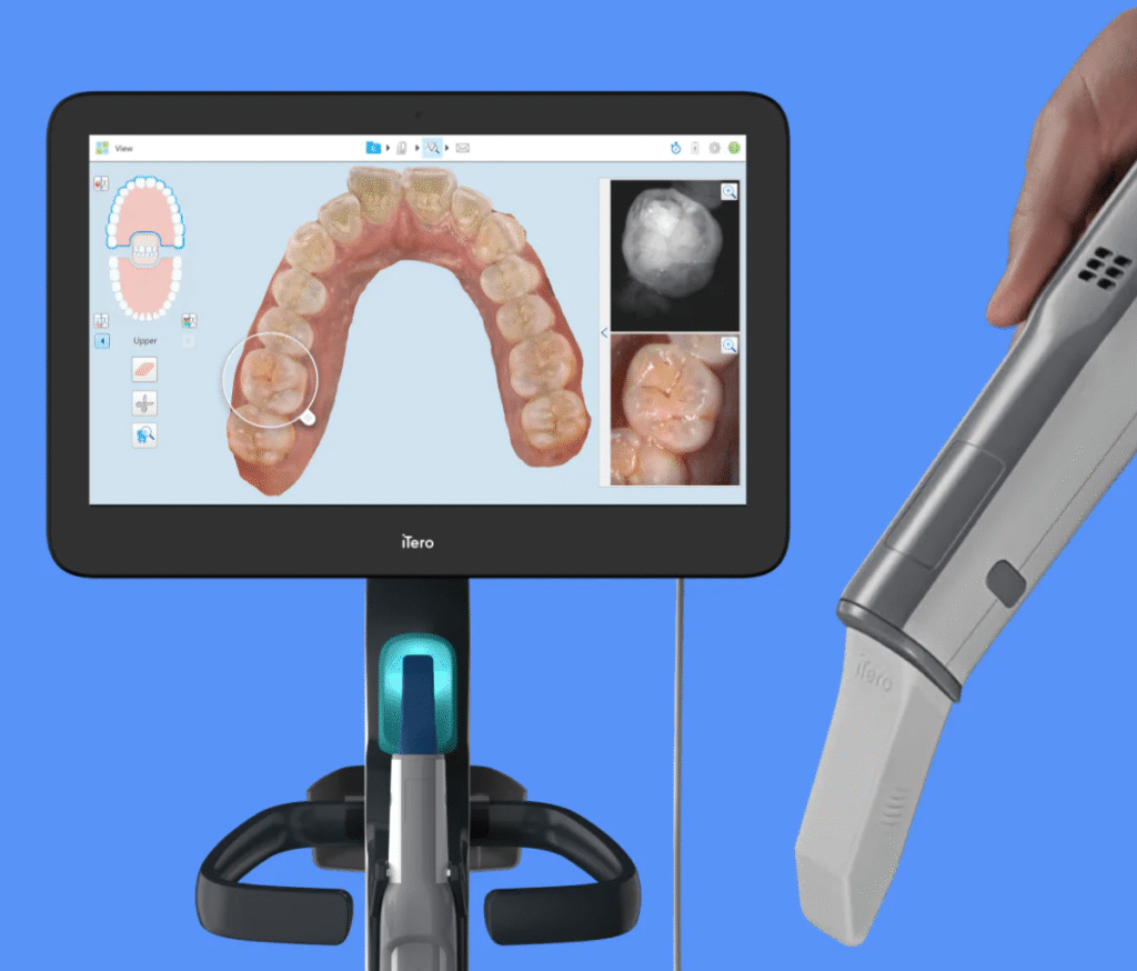 digital smile preview