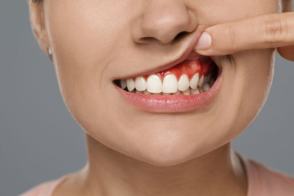 abscess treatment in kingsway