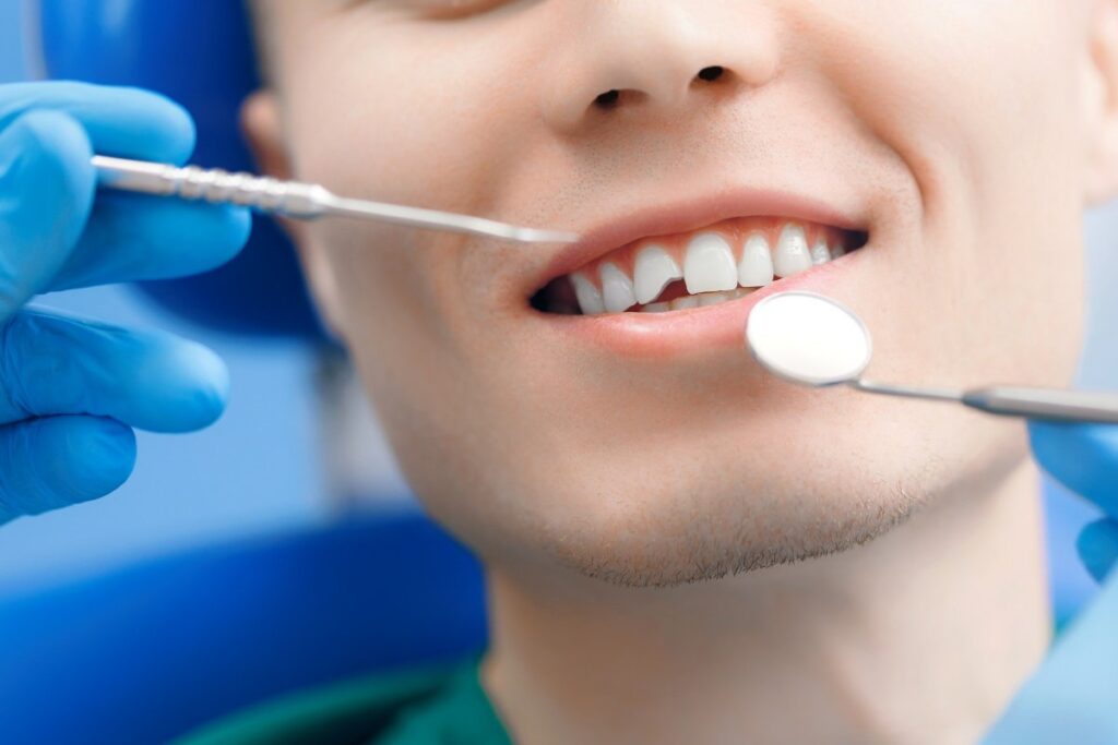broken or knocked out tooth in kingsway