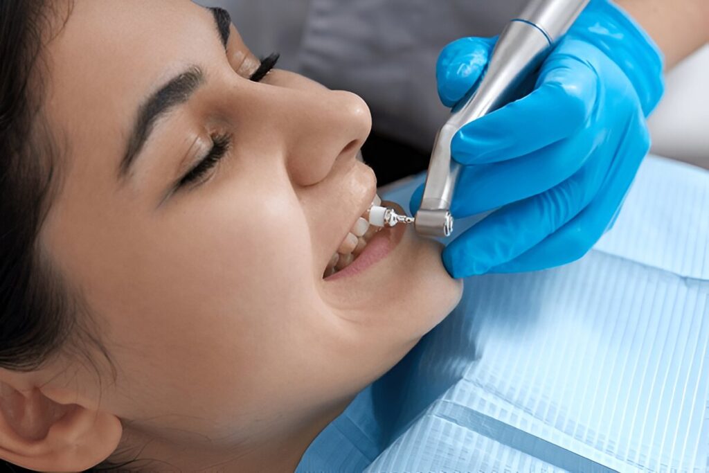 dental cleanings near you