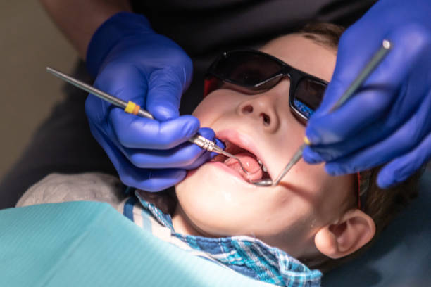 fluoride treatment in kingsway