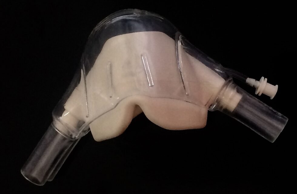 iv sedation in kingsway