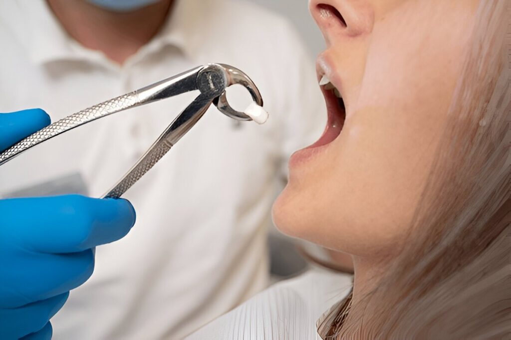tooth extraction in kingsway